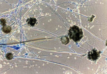 Some finer details about Black Fungus Black Fungus
