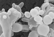 Now the white fungus attack for Corona patients white funus