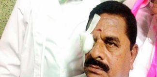 Telangana Legislative Council chairman Swamy's Goud cornea is ...