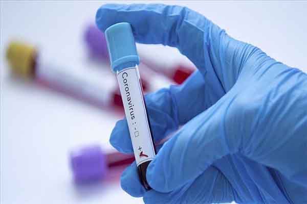 3 new coronavirus cases in Telangana