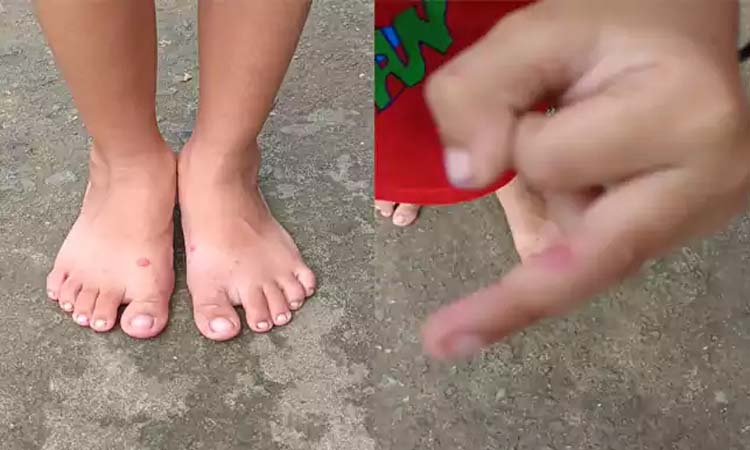 MP:టమాటా వైరస్ కలకలం