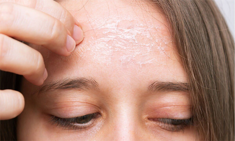 Omega-3:ఓమేగా-3 లోపమా?