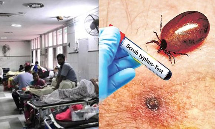 AP:పెరుగుతున్న స్క్రబ్ టైఫస్ కేసులు