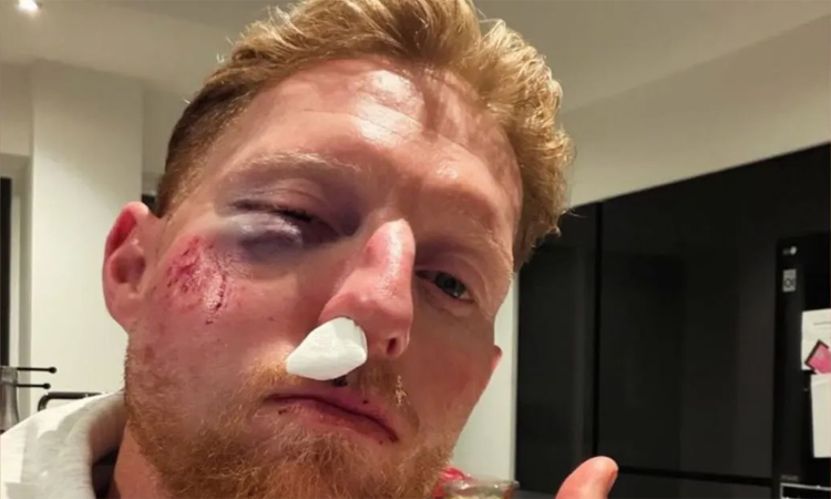 ఇంగ్లండ్ కెప్టెన్ బెన్ స్టోక్స్‌కు గాయాలు