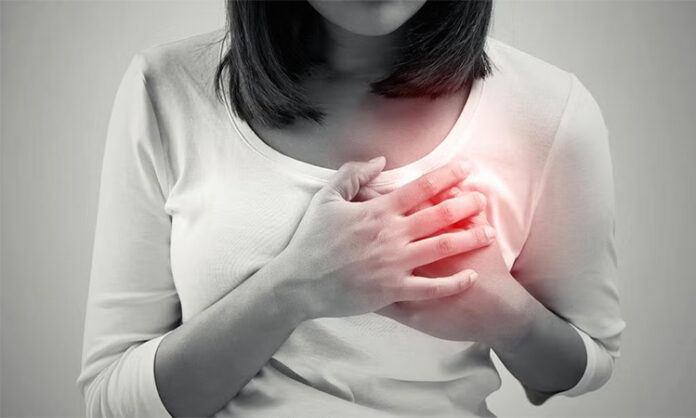Heart Attack